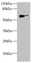 SLC22A8 / OAT3 Antibody - Western blot All Lanes: SLC22A8antibody IgG at 1.62ug/ml+ Mouse kidney tissue Secondary Goat polyclonal to rabbit IgG at 1/10000 dilution Predicted band size: 60,61,47,12,50 kDa Observed band size: 60 kDa