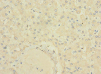 SLC22A9 / OAT7 Antibody - Immunohistochemistry of paraffin-embedded human liver tissue using SLC22A9 Antibody at dilution of 1:100