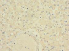 SLC22A9 / OAT7 Antibody - Immunohistochemistry of paraffin-embedded human liver tissue using SLC22A9 Antibody at dilution of 1:100