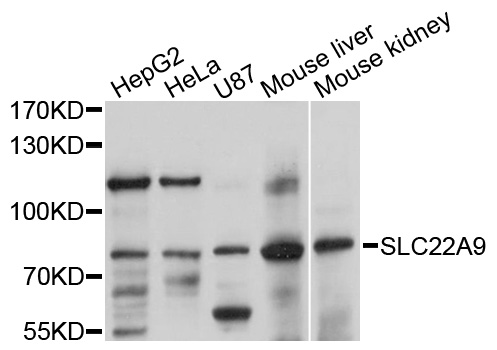 SLC22A9 / OAT7 Antibody - Western blot analysis of extracts of various cell lines, using SLC22A9 antibody at 1:1000 dilution. The secondary antibody used was an HRP Goat Anti-Rabbit IgG (H+L) at 1:10000 dilution. Lysates were loaded 25ug per lane and 3% nonfat dry milk in TBST was used for blocking. An ECL Kit was used for detection and the exposure time was 10s.