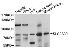 SLC22A9 / OAT7 Antibody - Western blot analysis of extracts of various cell lines, using SLC22A9 antibody at 1:1000 dilution. The secondary antibody used was an HRP Goat Anti-Rabbit IgG (H+L) at 1:10000 dilution. Lysates were loaded 25ug per lane and 3% nonfat dry milk in TBST was used for blocking. An ECL Kit was used for detection and the exposure time was 10s.