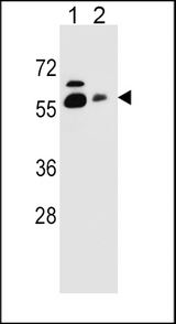 SLC23A1 / SVCT1 Antibody - SLC23A1 Antibody western blot of HepG2(lane 1),NCI-H292(lane 2) cell line lysates (35 ug/lane). The SLC23A1 antibody detected the SLC23A1 protein (arrow).