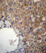 SLC23A1 / SVCT1 Antibody - SLC23A1 Antibody immunohistochemistry of formalin-fixed and paraffin-embedded human liver tissue followed by peroxidase-conjugated secondary antibody and DAB staining.