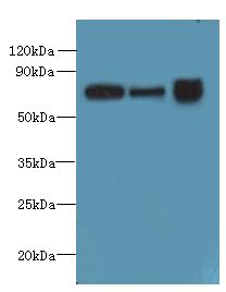 SLC23A1 / SVCT1 Antibody - Western blot. All lanes: SLC23A1 antibody at 3 ug/ml. Lane 1: A549 whole cell lysate. Lane 2: Mouse liver tissue. Lane 3: Mouse kidney tissue. Secondary antibody: Goat polyclonal to Rabbit IgG at 1:10000 dilution. Predicted band size: 65 kDa. Observed band size: 65 kDa.
