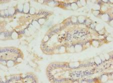SLC23A1 / SVCT1 Antibody - Immunohistochemistry of paraffin-embedded human small intestine using antibody at dilution of 1:100.