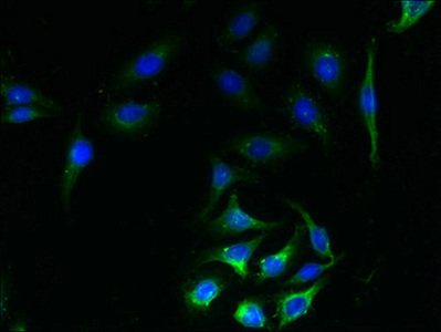 SLC23A1 / SVCT1 Antibody - Immunofluorescent analysis of A549 cells using SLC23A1 Antibody at dilution of 1:100 and Alexa Fluor 488-congugated AffiniPure Goat Anti-Rabbit IgG(H+L)