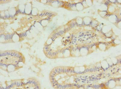 SLC23A1 / SVCT1 Antibody - Immunohistochemistry of paraffin-embedded human small intestine tissue using SLC23A1 Antibody at dilution of 1:100