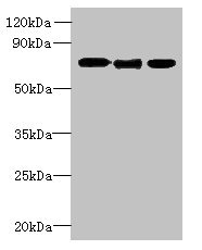 SLC23A1 / SVCT1 Antibody - Western blot All lanes: SLC23A1 antibody at 3µg/ml Lane 1: A549 whole cell lysate Lane 2: Mouse liver tissue Lane 3: Mouse kidney tissue Secondary Goat polyclonal to rabbit IgG at 1/10000 dilution Predicted band size: 65, 66, 29 kDa Observed band size: 65 kDa