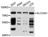 SLC23A1 / SVCT1 Antibody - Western blot analysis of extracts of various cell lines, using SLC23A1 antibody at 1:1000 dilution. The secondary antibody used was an HRP Goat Anti-Rabbit IgG (H+L) at 1:10000 dilution. Lysates were loaded 25ug per lane and 3% nonfat dry milk in TBST was used for blocking. An ECL Kit was used for detection and the exposure time was 10s.