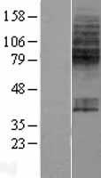 SLC23A1 / SVCT1 Protein - Western validation with an anti-DDK antibody * L: Control HEK293 lysate R: Over-expression lysate