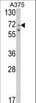SLC23A2 / SVCT2 Antibody - Western blot of SLC23A2 Antibody in A375 cell line lysates (35 ug/lane). SLC23A2 (arrow) was detected using the purified antibody.
