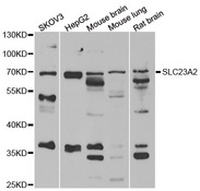 SLC23A2 / SVCT2 Antibody - Western blot analysis of extracts of various cell lines.