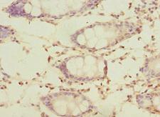 SLC23A2 / SVCT2 Antibody - Immunohistochemistry of paraffin-embedded human rectum tissue at dilution 1:100