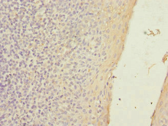 SLC23A2 / SVCT2 Antibody - Immunohistochemistry of paraffin-embedded human tonsil tissue at dilution 1:100