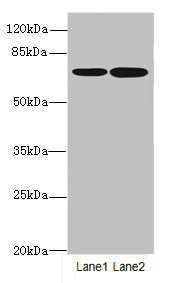SLC23A2 / SVCT2 Antibody - Western blot All Lanes: SLC23A2antibody at 3.16ug/ml Lane 1 : SH-SY5Y whole cell lysate Lane 2 : A375 whole cell lysate Secondary Goat polyclonal to Rabbit IgG at 1/10000 dilution Predicted band size: 71,59 kDa Observed band size: 70 kDa