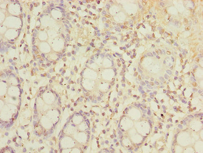SLC23A2 / SVCT2 Antibody - Immunohistochemistry of paraffin-embedded human colon tissue using SLC23A2 Antibody at dilution of 1:100