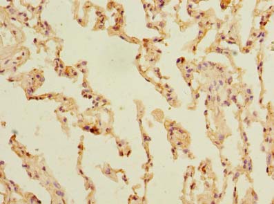SLC23A3 Antibody - Immunohistochemistry of paraffin-embedded human skin tissue using antibody at dilution of 1:100.