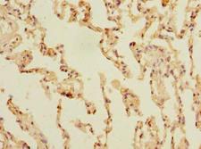 SLC23A3 Antibody - Immunohistochemistry of paraffin-embedded human skin tissue using antibody at dilution of 1:100.