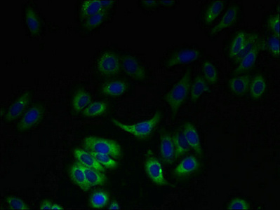 SLC23A3 Antibody - Immunofluorescent analysis of HepG2 cells using SLC23A3 Antibody at dilution of 1:100 and Alexa Fluor 488-congugated AffiniPure Goat Anti-Rabbit IgG(H+L)