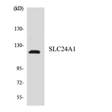 SLC24A1 / NCKX Antibody - Western blot analysis of the lysates from HepG2 cells using SLC24A1 antibody.