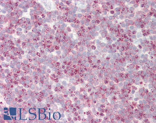 SLC24A1 / NCKX Antibody - Anti-SLC24A1 / NCKX antibody IHC staining of human tonsil. Immunohistochemistry of formalin-fixed, paraffin-embedded tissue after heat-induced antigen retrieval. Antibody concentration 10 ug/ml.  This image was taken for the unconjugated form of this product. Other forms have not been tested.