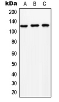 SLC24A1 / NCKX Antibody - Western blot analysis of NCKX1 expression in HeLa (A); SP2/0 (B); NIH3T3 (C) whole cell lysates.