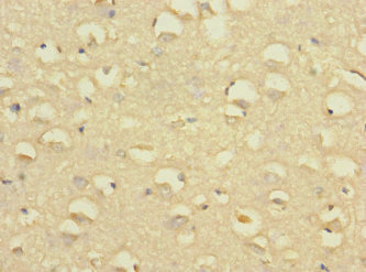 SLC24A1 / NCKX Antibody - Immunohistochemistry of paraffin-embedded human brain tissue at dilution 1:100