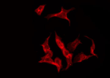 SLC24A1 / NCKX Antibody - Staining RAW264.7 cells by IF/ICC. The samples were fixed with PFA and permeabilized in 0.1% Triton X-100, then blocked in 10% serum for 45 min at 25°C. The primary antibody was diluted at 1:200 and incubated with the sample for 1 hour at 37°C. An Alexa Fluor 594 conjugated goat anti-rabbit IgG (H+L) Ab, diluted at 1/600, was used as the secondary antibody.