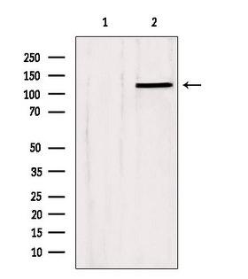 SLC24A1 / NCKX Antibody - Western blot analysis of extracts of HeLa cells using SLC24A1 antibody. Lane 1 was treated with the blocking peptide.