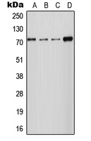 SLC24A2 / NCKX2 Antibody - Western blot analysis of NCKX2 expression in HT1080 (A); MCF7 (B); Raw264.7 (C); PC12 (D) whole cell lysates.