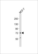 SLC24A2 / NCKX2 Antibody - Anti-NCKX2 Antibody at 1:1000 dilution + MCF-7 whole cell lysates Lysates/proteins at 20 ug per lane. Secondary Goat Anti-Rabbit IgG, (H+L),Peroxidase conjugated at 1/10000 dilution Predicted band size : 74 kDa Blocking/Dilution buffer: 5% NFDM/TBST.