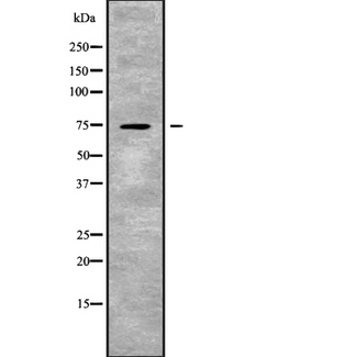 SLC24A2 / NCKX2 Antibody - Western blot analysis SLC24A2 using COLO205 whole cells lysates