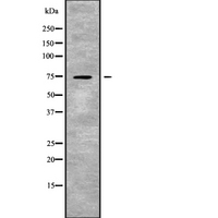 SLC24A2 / NCKX2 Antibody - Western blot analysis SLC24A2 using COLO205 whole cells lysates