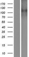 SLC24A2 / NCKX2 Protein - Western validation with an anti-DDK antibody * L: Control HEK293 lysate R: Over-expression lysate