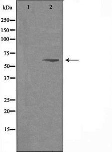SLC24A3 / NCKX3 Antibody - Western blot analysis of extracts of K562 cells using SLC24A3 antibody. The lane on the left is treated with the antigen-specific peptide.