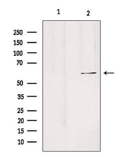 SLC24A3 / NCKX3 Antibody - Western blot analysis of extracts of HeLa cells using SLC24A3 antibody. Lane 1 was treated with the blocking peptide.