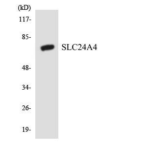 SLC24A4 / NCKX4 Antibody - Western blot analysis of the lysates from HeLa cells using SLC24A4 antibody.