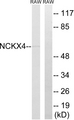 SLC24A4 / NCKX4 Antibody - Western blot analysis of lysates from RAW264.7 cells, using SLC24A4 Antibody. The lane on the right is blocked with the synthesized peptide.