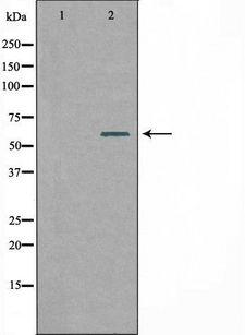 SLC24A4 / NCKX4 Antibody - Western blot analysis of extracts of RAW264.7 cells using SLC24A4 antibody. The lane on the left is treated with the antigen-specific peptide.
