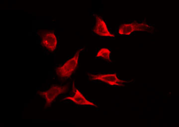 SLC24A4 / NCKX4 Antibody - Staining RAW264.7 cells by IF/ICC. The samples were fixed with PFA and permeabilized in 0.1% Triton X-100, then blocked in 10% serum for 45 min at 25°C. The primary antibody was diluted at 1:200 and incubated with the sample for 1 hour at 37°C. An Alexa Fluor 594 conjugated goat anti-rabbit IgG (H+L) Ab, diluted at 1/600, was used as the secondary antibody.
