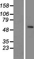 SLC24A5 / NCKX5 Protein - Western validation with an anti-DDK antibody * L: Control HEK293 lysate R: Over-expression lysate