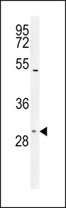 SLC25A1 / SEA Antibody - TXTP Antibody western blot of Jurkat cell line lysates (35 ug/lane). The TXTP antibody detected the TXTP protein (arrow).