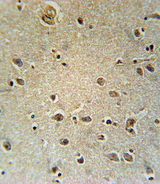 SLC25A1 / SEA Antibody - TXTP Antibody immunohistochemistry of formalin-fixed and paraffin-embedded human brain tissue followed by peroxidase-conjugated secondary antibody and DAB staining.