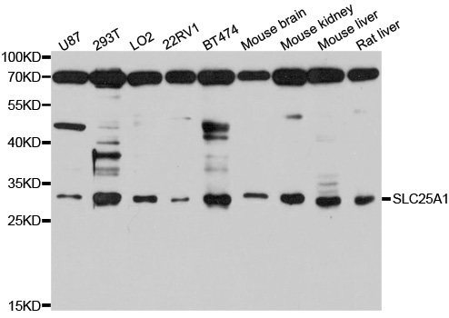 SLC25A1 / SEA Antibody - Western blot analysis of extracts of various cell lines, using SLC25A1 antibody at 1:1000 dilution. The secondary antibody used was an HRP Goat Anti-Rabbit IgG (H+L) at 1:10000 dilution. Lysates were loaded 25ug per lane and 3% nonfat dry milk in TBST was used for blocking. An ECL Kit was used for detection and the exposure time was 30s.