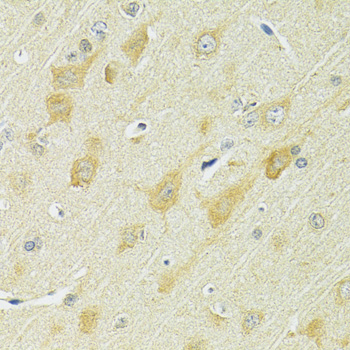 SLC25A1 / SEA Antibody - Immunohistochemistry of paraffin-embedded rat brain using SLC25A1 antibodyat dilution of 1:100 (40x lens).