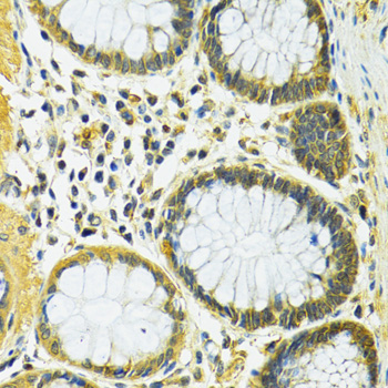 SLC25A1 / SEA Antibody - Immunohistochemistry of paraffin-embedded human colon using SLC25A1 antibodyat dilution of 1:100 (40x lens).