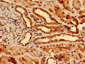 SLC25A1 / SEA Antibody - Immunohistochemistry image of paraffin-embedded human kidney tissue at a dilution of 1:100