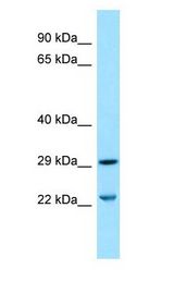 SLC25A10 / DIC Antibody - SLC25A10 / DIC antibody Western Blot of THP-1.  This image was taken for the unconjugated form of this product. Other forms have not been tested.
