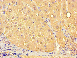 SLC25A10 / DIC Antibody - Immunohistochemistry of paraffin-embedded human liver tissue at dilution 1:100