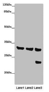 SLC25A10 / DIC Antibody - Western blot All Lanes: SLC25A10 antibody at 16 ug/ml Lane 1: Mouse liver tissue Lane 2: Mouse kidney tissue Lane 3: HepG-2 whole cell lysate Secondary Goat polyclonal to rabbit IgG at 1/10000 dilution Predicted band size: 32,33 kDa Observed band size: 31,24 kDa